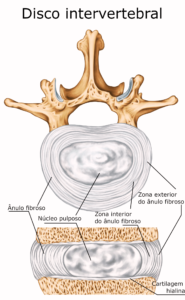 o que é um disco intervertebral
